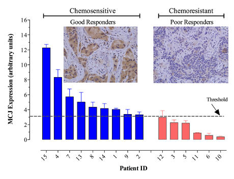 MCJ expression influences the clinical response to chemotherapy. Tumour MCJ levels quantitated using real-time PCR in individual patients and correlated with their response in neoadjuvant chemotherapy. Patients whose tumours expressed MCJ levels below 3.1 units were poor responders. Inset panels show representative breast tissue sections after staining for MCJ protein.